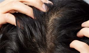 2023再生资源回收行业运营格局分析(图5)